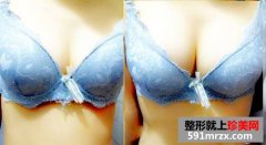 ר�ҽ�����¡�ؼ����ǰ������