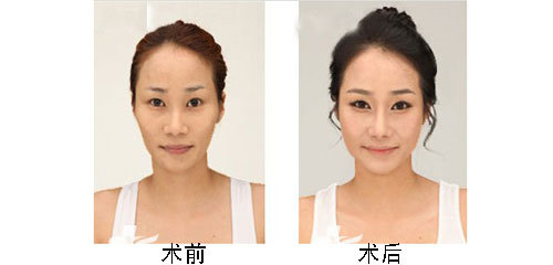 ������¡���Ƿ��к���֢