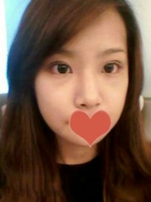 面部整形 从女屌丝变女神 - 珍美网