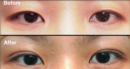 ����˫��Ƥ���������Ƕ��� - ������