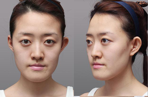 �沿���� ��Ȼһ�³�Ϊ�������Լ� - ������