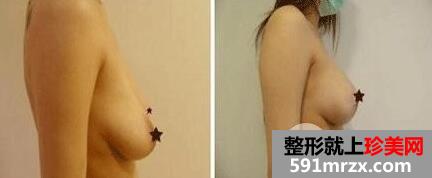 ������������ʽȫ��������Ч��ͼƬ