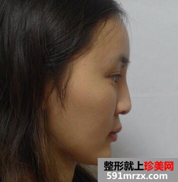 ����¡��һ��7��ָ�ͼ����¡�Ǽ�ʵ