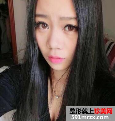 ��������ӻָ�����ͼƬ