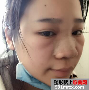 ��������ӻָ�����ͼƬ