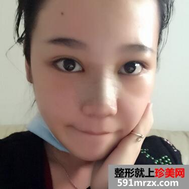 ��������ӻָ�����ͼƬ