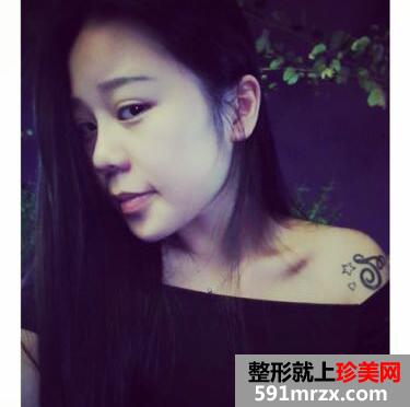 ��������ӻָ�����ͼƬ