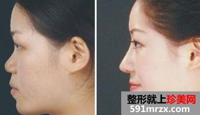 铜陵黄雷医疗美容医院详细价格表遭爆出