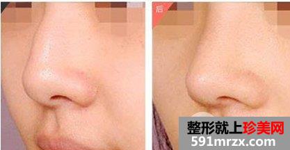 ��ǽ����������������ף���ûָ�