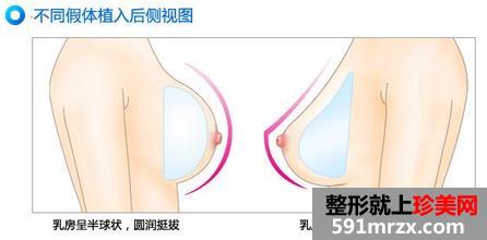 ������ɽ����ҽԺ¡�ؼ۸�����ʳ�¯