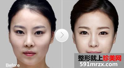 ��̨��ٻԴ����ҽԺ2017�۸������һ��