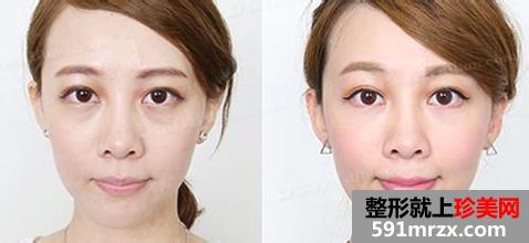 ��̨��������ҽԺ2017�۸������һ��