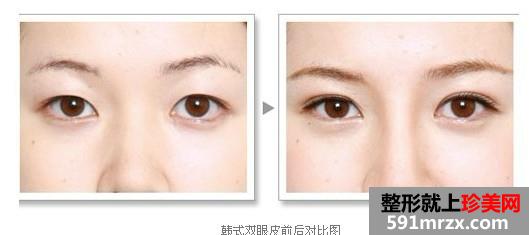 ��������������ҽԺ2017�¼۸���ع�