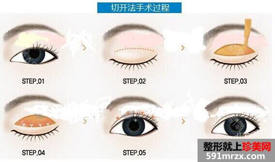 ����ҽ������ҽԺ2017�¼۸���ع�