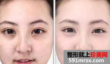 ��̨��������ҽԺ�۸���³�¯