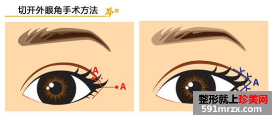 ��̨��������ҽԺ�¼۸����¯