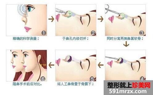 ��̨��������ҽԺ�¼۸����ϸһ��