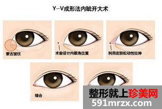 ��̨ƽƽ����ҽԺ�¼۸����ϸһ��