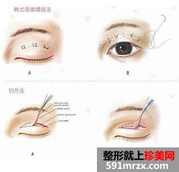 �˳���ɽ��������ҽԺ�۸�����ع�һ��