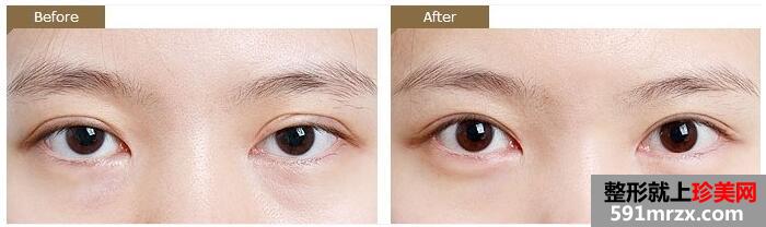 �����������ҽԺ�۸�������ع�