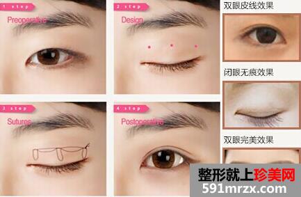 ����ҽ�������������ļ۸��2017���ع�