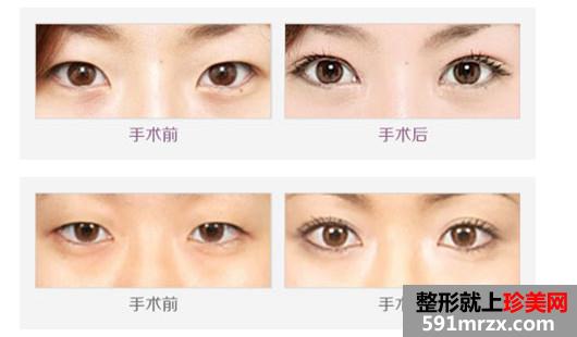 �����������ݻ����۸��2017���ع�