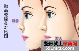 �˳���������ҽԺ�Ƴ�ȫ�����ż۸�һ����