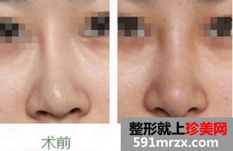 ����¡�Ǽ���ȡ������Ǯ��