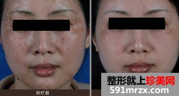 ���ǰ��Ա�ͼ