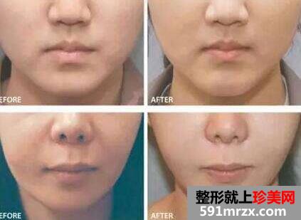 �沿����ǰ��Ա�ͼ