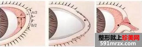 ���۽�һ��Ҫ�ָ���ã�