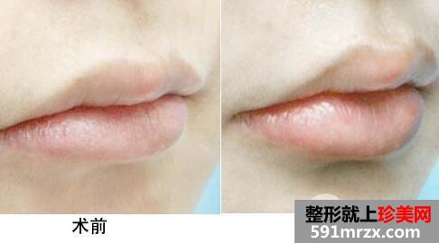 �ᴽ��������ʲô�������أ�