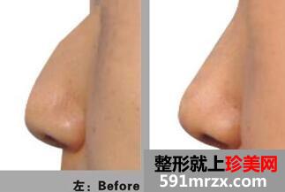 �շ�ǽ�����Ǯ