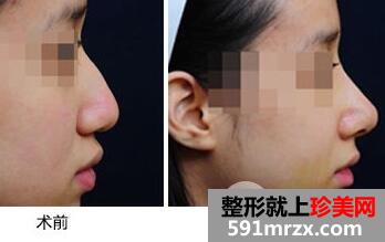 �շ�ǽ�����Ǯ