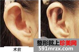 �з������ҽԺ�ļҺ�?����ҽԺ�Ƽ�