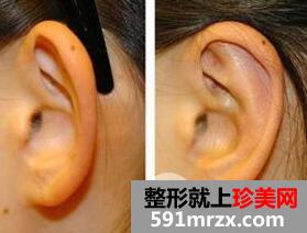 �з������������ȫ��?����Ǯ��