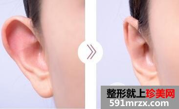 �з������ǰ��Ա�ͼ���з������������ȫ��?����Ǯ��