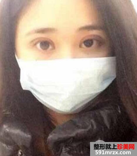 ʱ����������ҽԺ˫��Ƥ�������������μ۸��