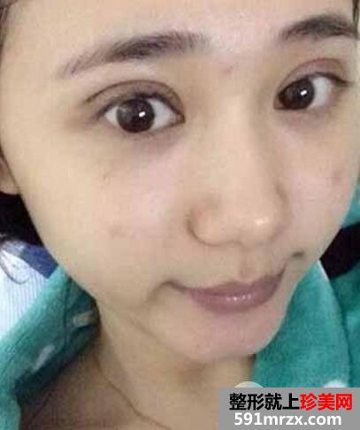 ʱ����������ҽԺ˫��Ƥ�������������μ۸��