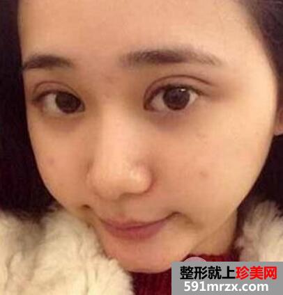 ʱ����������ҽԺ˫��Ƥ�������������μ۸��