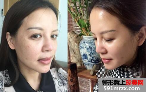 北京301医院整形美容科网上预约挂号和整形价格表