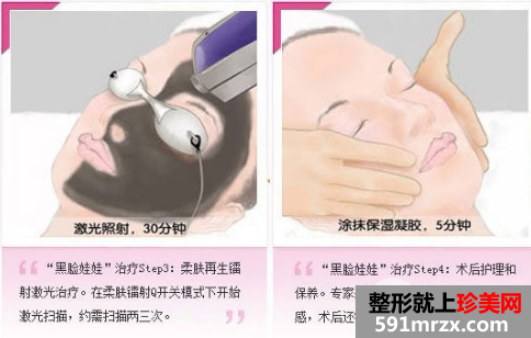 ��������������Ч����ô��������ҽԺ�Ƽ�