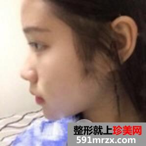 ���Ǻ�����������ҽԺ�۸��,¡�ǰ���Ч���Ա�ͼ����~