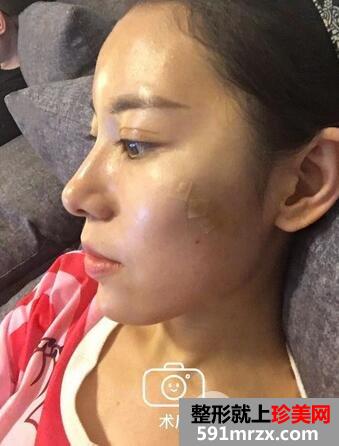 ����ȥ�Ǵ���3