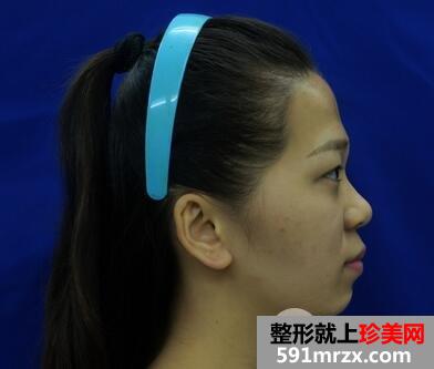 ����֬�����ͷ��������θı�������ı�ƽ��ͷ��