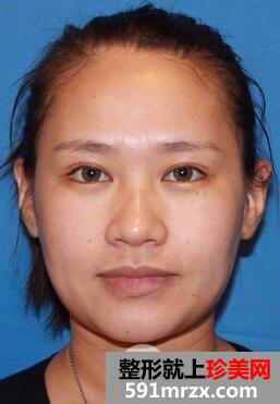 �Ͳ�Ҽ�����μ۸�������ߵ�¡��+�����������Ͱ���