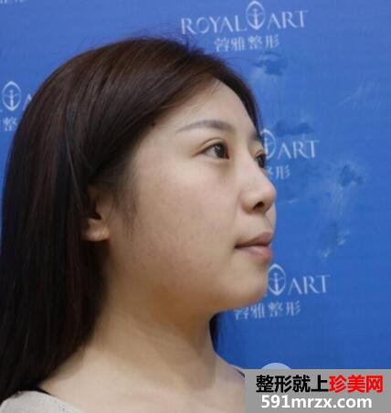 ��ţ���������������ݣ���������+�轺¡��