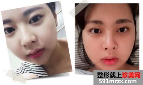 Сv���������ָ����̷�����ǰ��Ա���