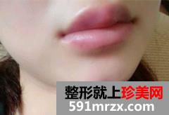 ע�䲣��������ϴ�ǰ��Ա�Ч��ͼƬ�ͻָ�����