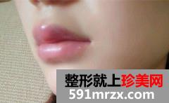 ע�䲣��������ϴ�ǰ��Ա�Ч��ͼƬ�ͻָ�����